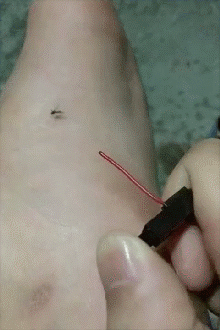 蚊子:这辈子都没想过会是这种死法! zt