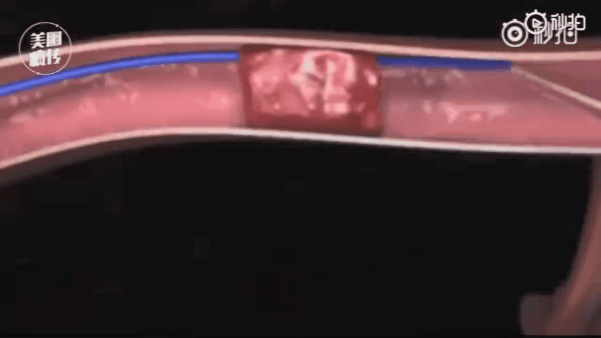 10种疏通人体血管的方法 zt