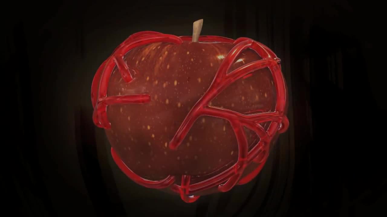 video-poster