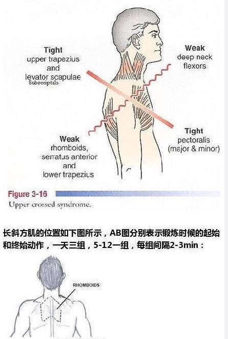 这些锻炼可以改善脖子前倾,让你拥有漂亮的天鹅颈! zt