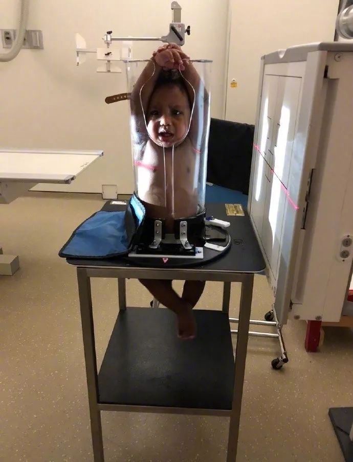 原来国外小朋友是这么照x光的zt