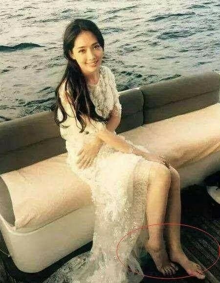女星脚太丑: 杨紫琼宋茜畸形, 王子文满是伤疤, 金星为脚骄傲.