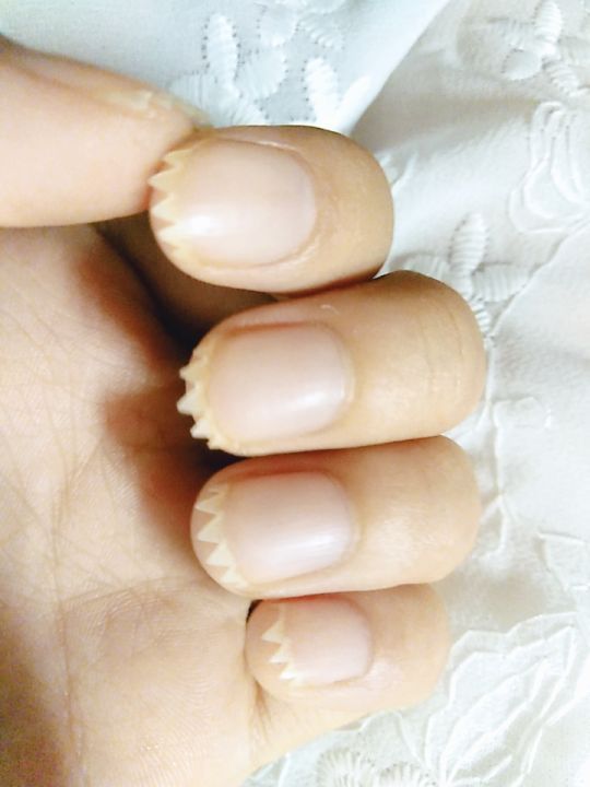 今天我暂且称它为,这指甲也太牛了!鲨鱼牙! zt